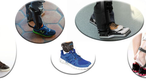 What is an exoskeleton?